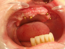 Oral surgery and Periodontology