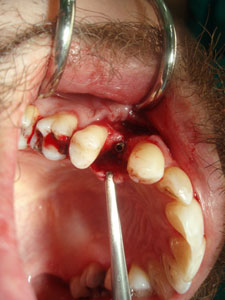 Oral surgery and Periodontology